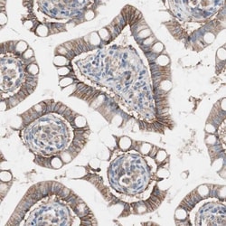 GPR160 Antibody, Novus Biologicals:Antibodies:Primary Antibodies